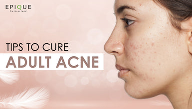 Adult Acne: Here’s Why You’re Breaking Up in Your 20s and 30s