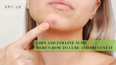 Acne on Chin and Jawline: What Causes It & How to Prevent It?