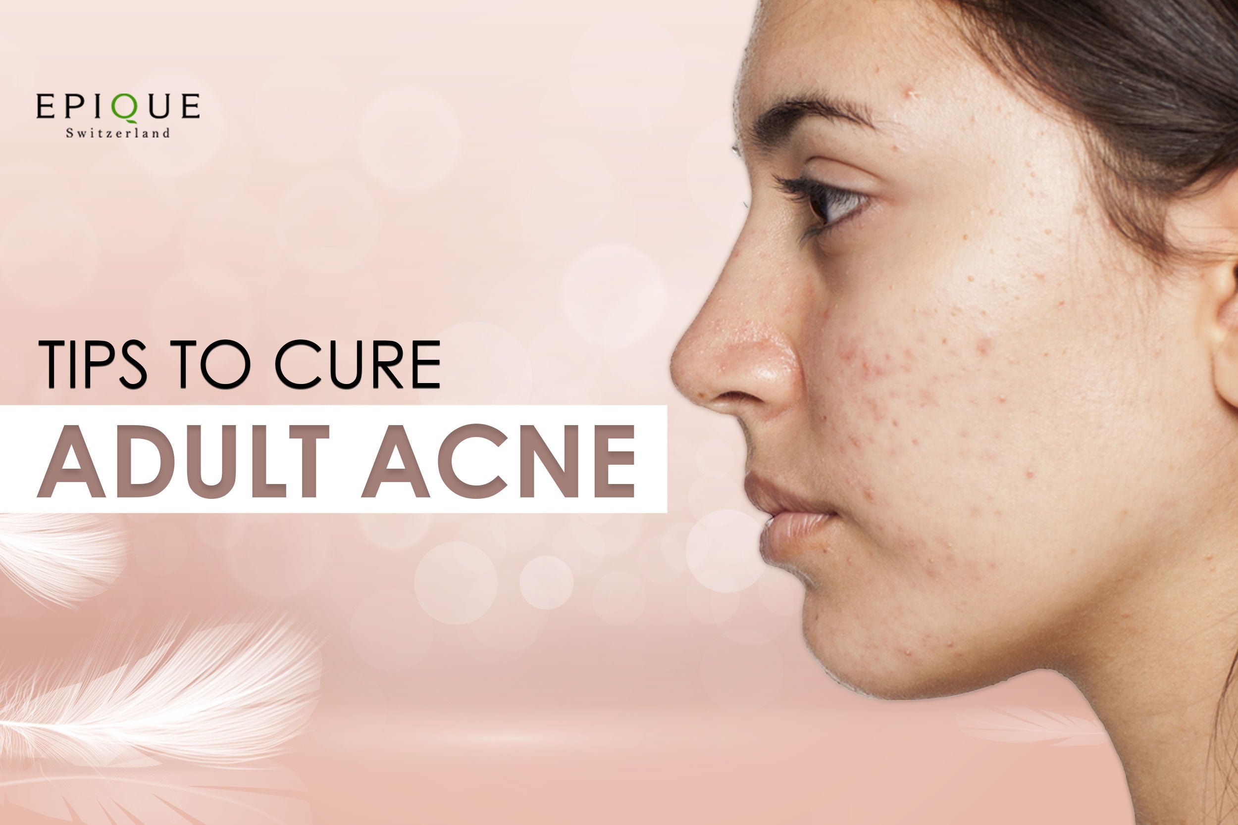Adult Acne: Here’s Why You’re Breaking Up in Your 20s and 30s